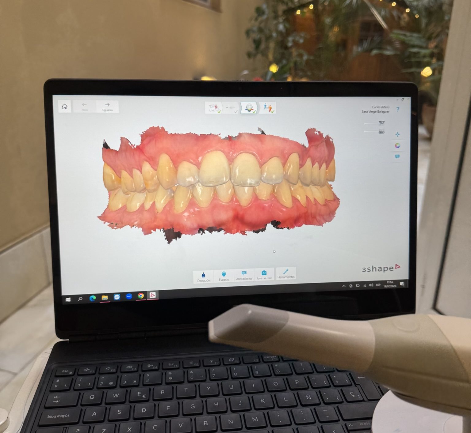 observando_dentadura2